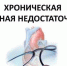 ​Хроническая сердечная недостаточность: причины развития и профилактика - Клиническая больница им. Н.А. Семашко