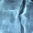 Врач Вадим Анапасюк рассказал, в чем опасность дисплазии соединительных тканей и есть ли преимущество - ProGorod62.Ru