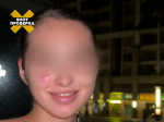 удевушкираспухла щека после патча